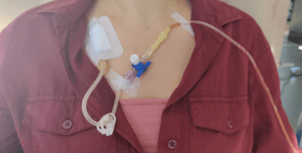 Portacath quimioterapia ficticio.