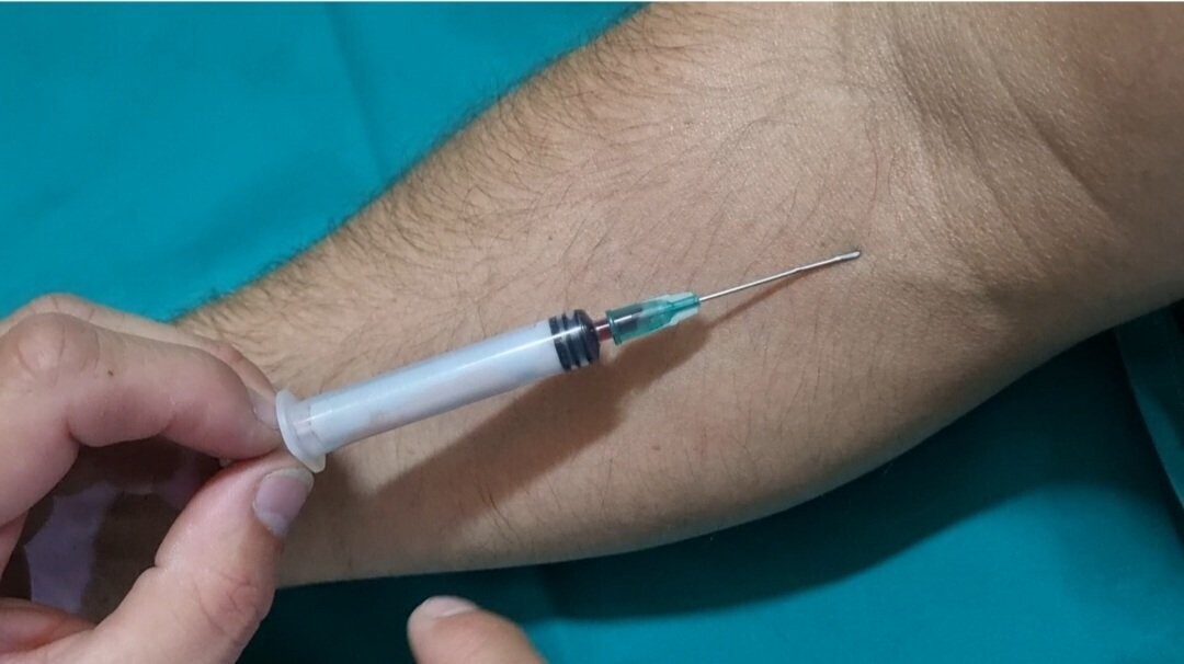 Jeringuilla FX. Jeringuilla trucada para extracción de sangre. Alquiler jeringuilla retractil.