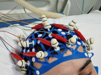 Electroencefalograma.