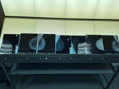 Lote de radiografías mamografía.