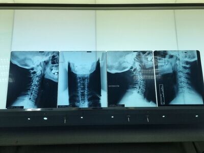 Lote radiografías cervical.
