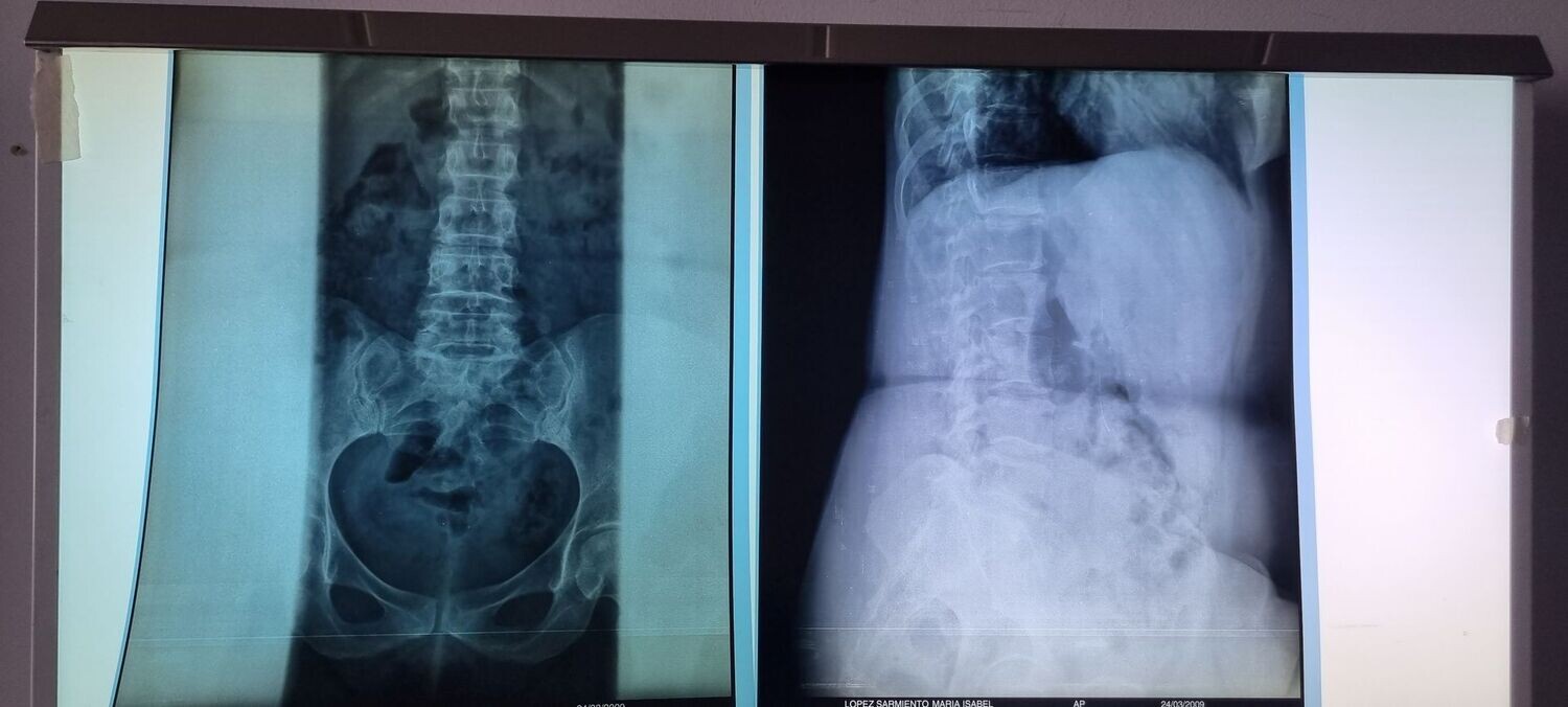 Radiografías de cadera.