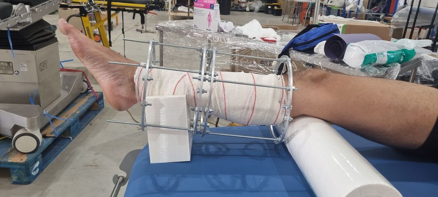 Fijador externo para tibia y peroné.