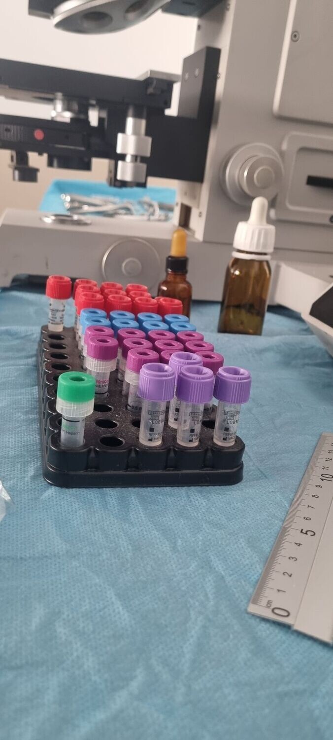 Tubos reactivos de pruebas biológicas. Pruebas forenses.