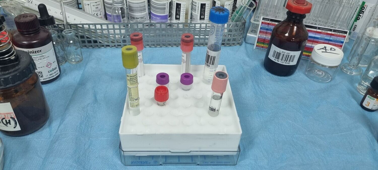 Gradilla para pruebas de ADN.
