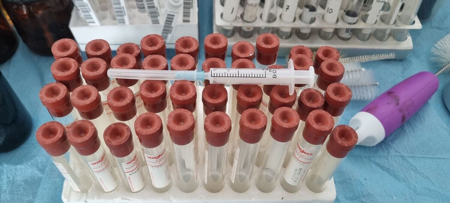 Tubos extracción de sangre años 90