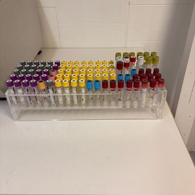 Rack con tubos muestras de sangre de pacientes para su análisis en el laboratorio de hematología. Alquiler atrezzo hospitales.