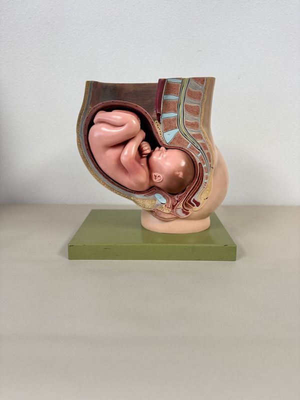 Modelo anatómico de la pelvis femenina. Alquiler modelo anatómico embarazo años 2000.