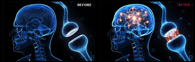 VigorUS Minderva Cognitive Brain
