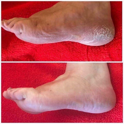 Sole Solution