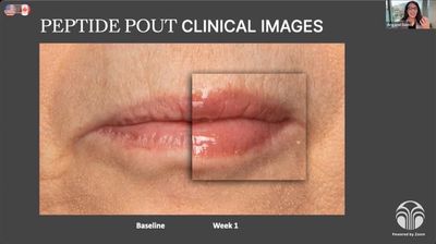 Lip Peptide Pout