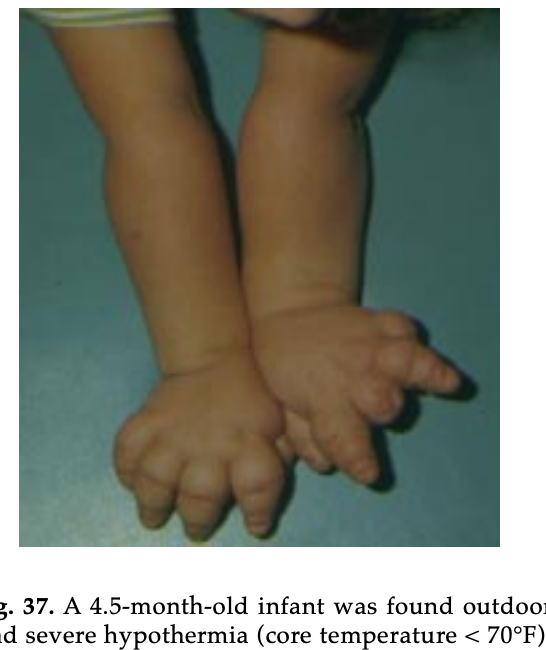 DOWNLOAD: Book #2 Pictorial Atlas of Freezing Cold Injuries