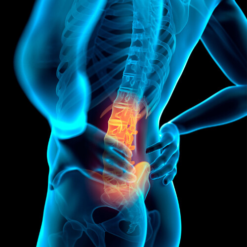 eBook: Fix your Lower Back Pain