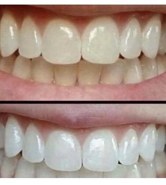 Ap 24 award Winning whitening Toothpaste Birthday Special