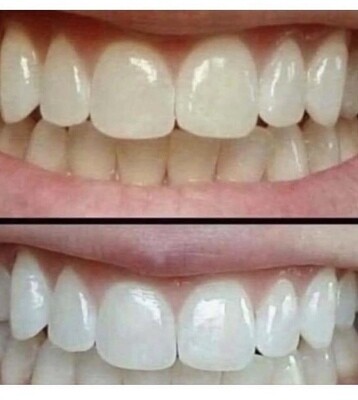 Ap 24 award Winning whitening Toothpaste Birthday Special