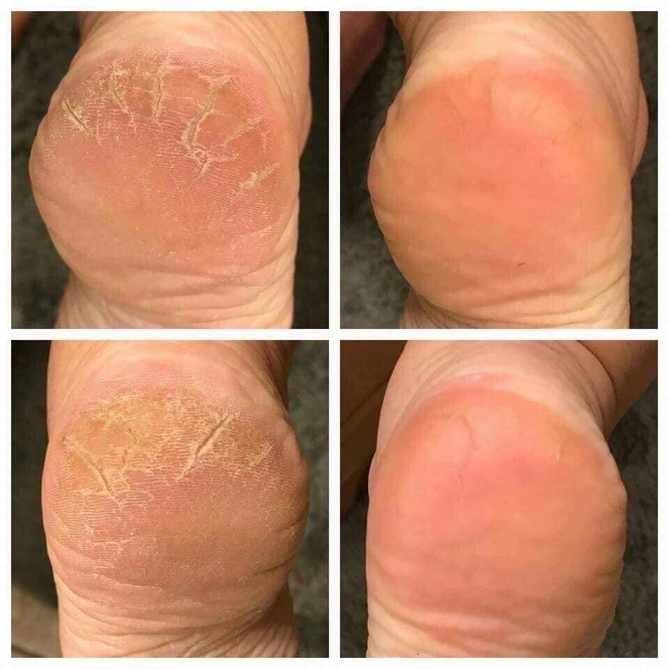 Sole Solution