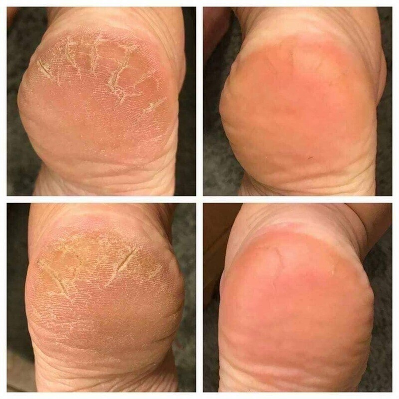 Sole Solution