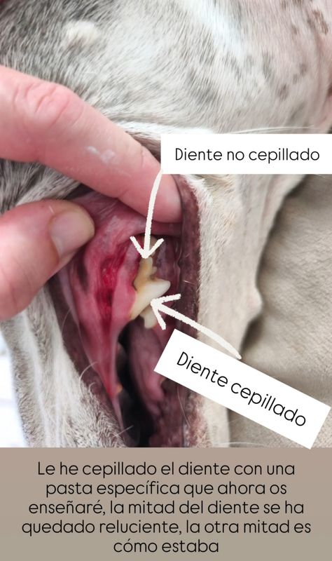 Destructor de placa 🦷