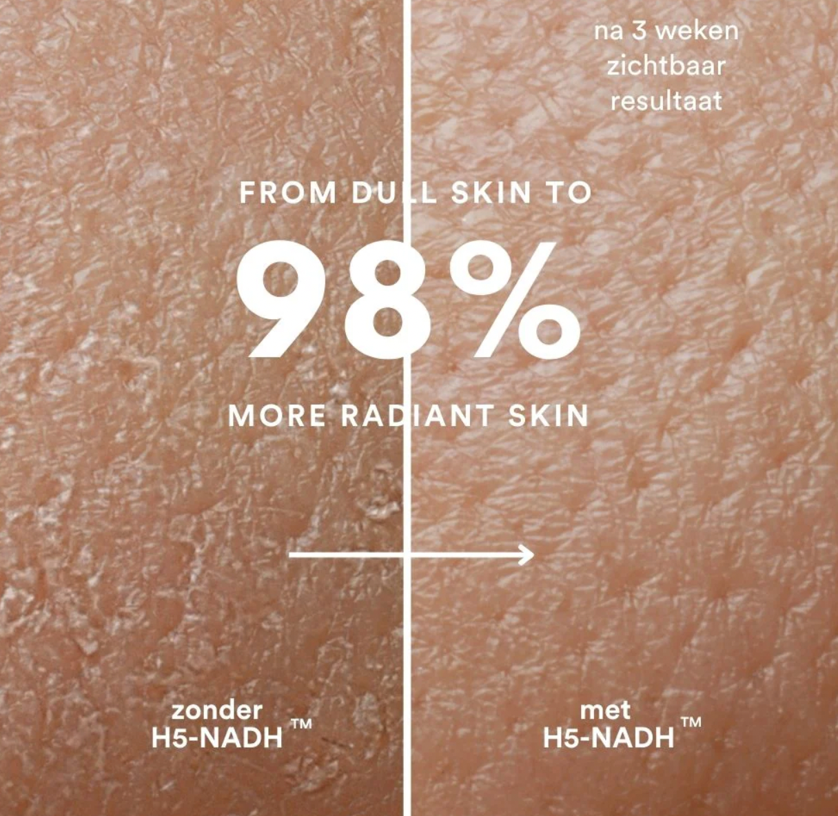 Insentials Inner Beauty H5-NADH™