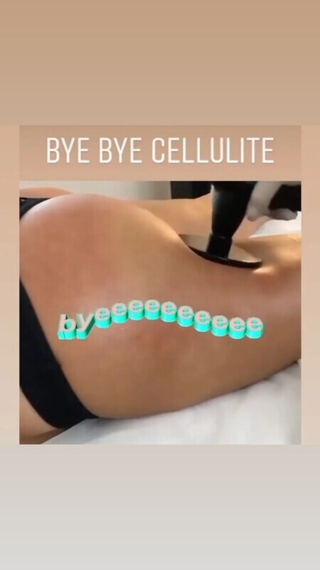 NUERA TIGHT LEG TREATMENT
