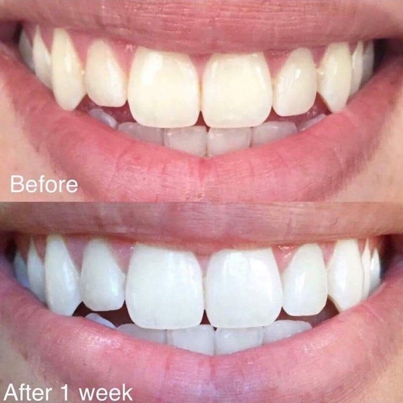 Whitening Toothpaste 