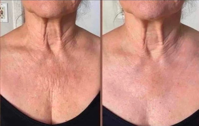 Cellulite/Dermatic Effects Firming Cream