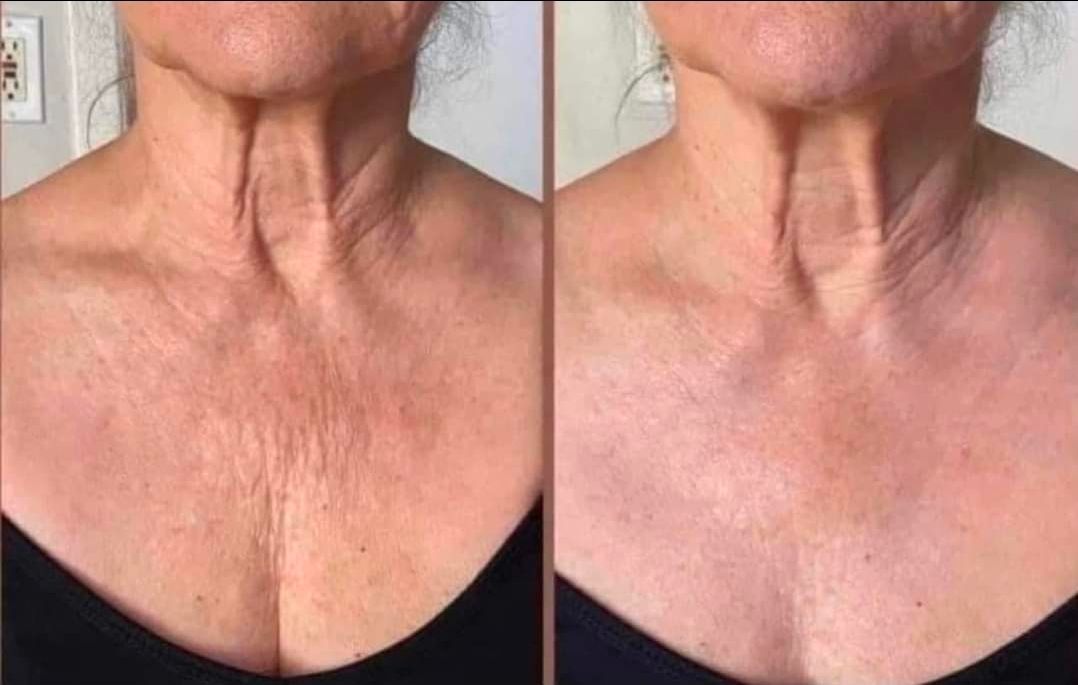 Cellulite/Dermatic Effects Firming Cream