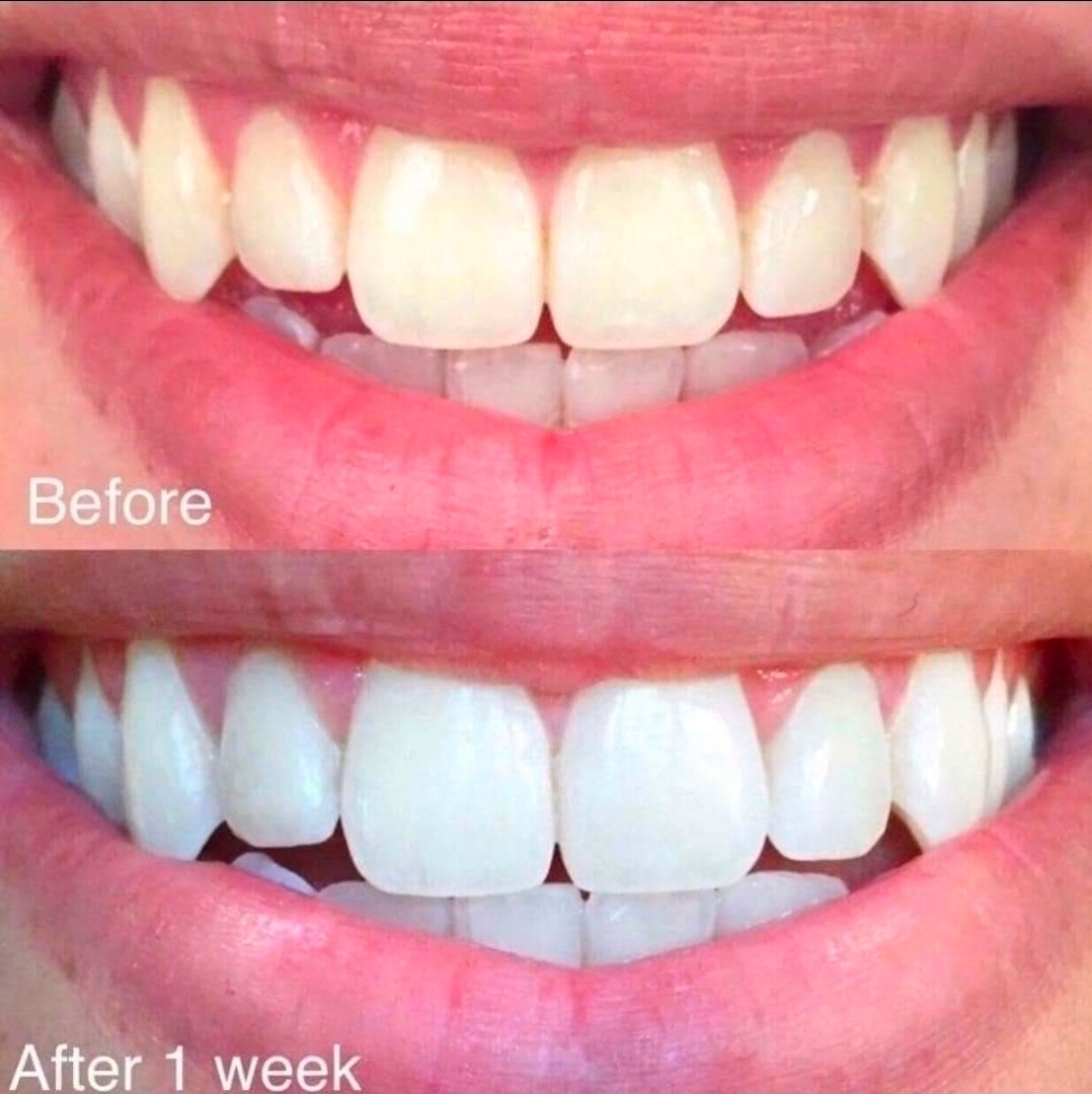 Whitening Toothpaste 