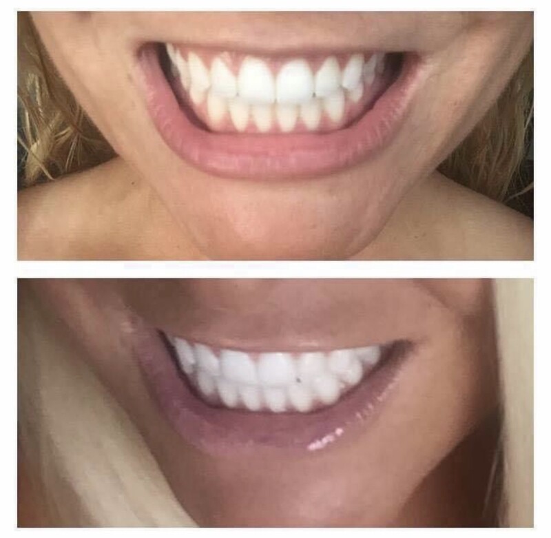 AP-24 Whitening Toothpaste