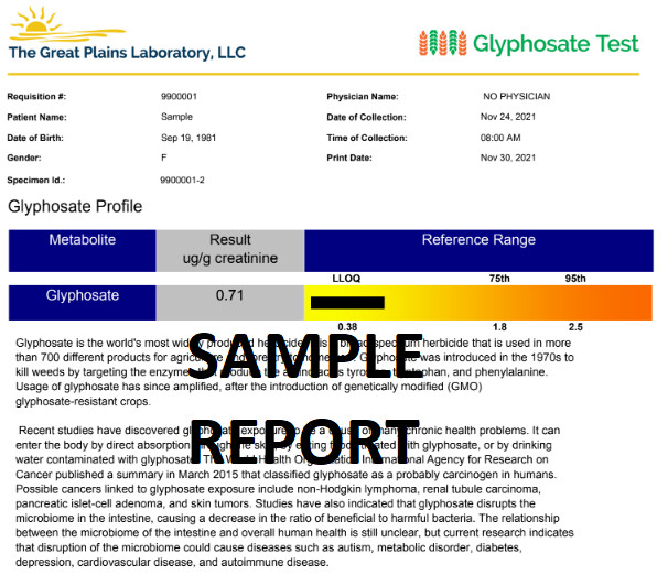 GPL Glyphosate Test