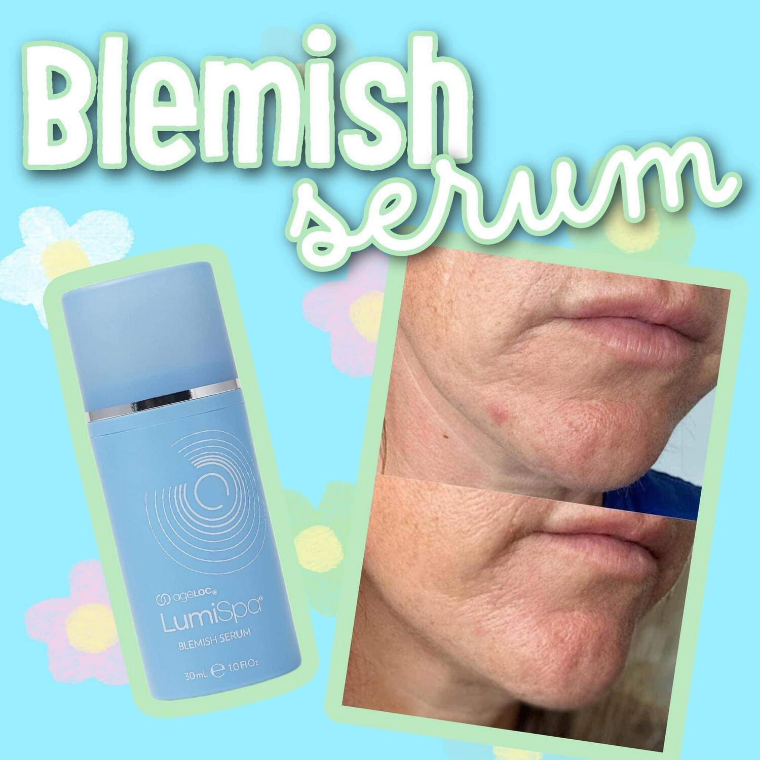 ageLOC LumiSpa Blemish Serum