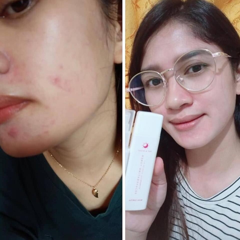 Beyouthiful Starter Kit
