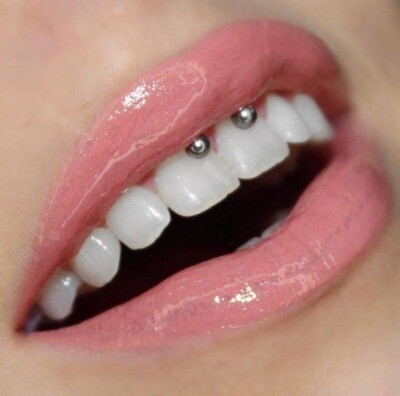 Smiley Piercing