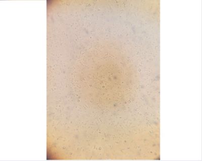 Bactallion Septic Tank Treatment 1 Litre