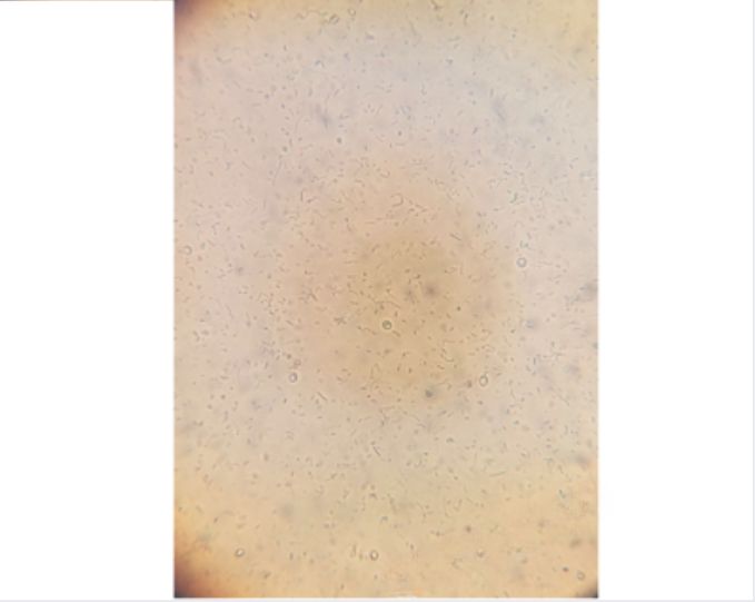 Bactallion Septic Tank Treatment 1 Litre