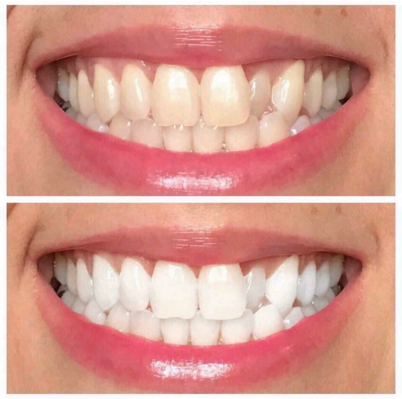 Fluoride Free Whitening Toothpaste