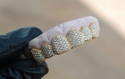 Custom Grillz