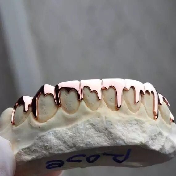 10k Gold 6 count "Drippy" grillz