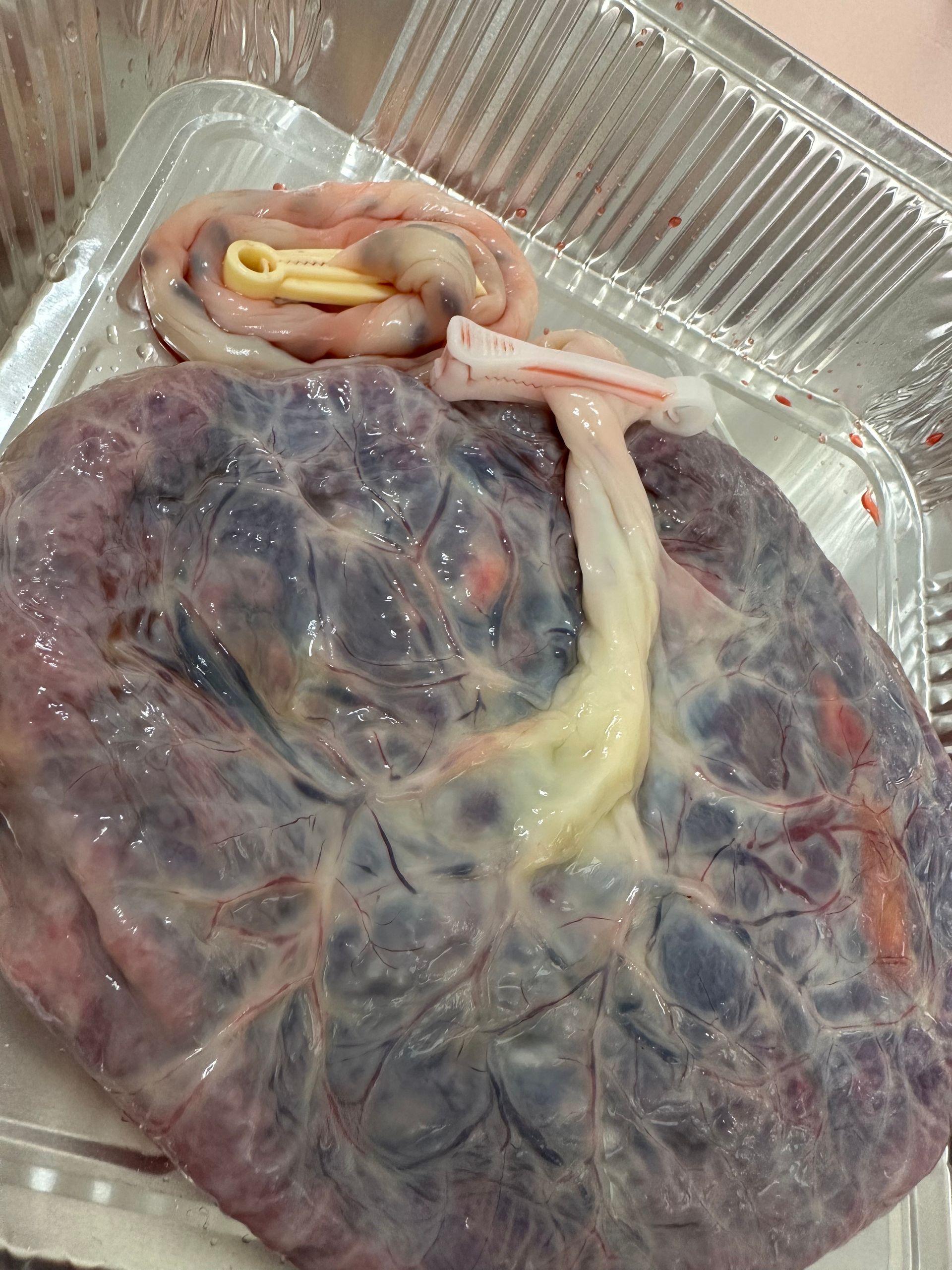 Placenta casting £135