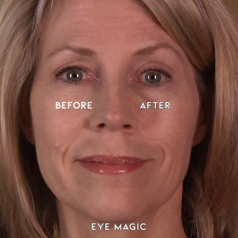 Butterfly Invisible Double Eye Lift