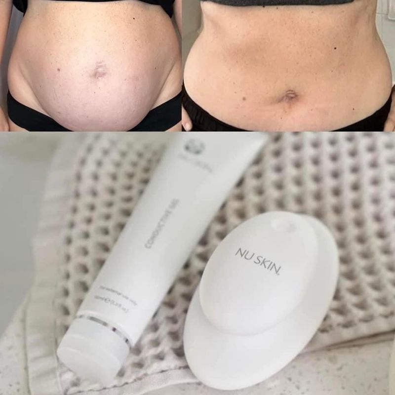Body Sculpting Device + Gel