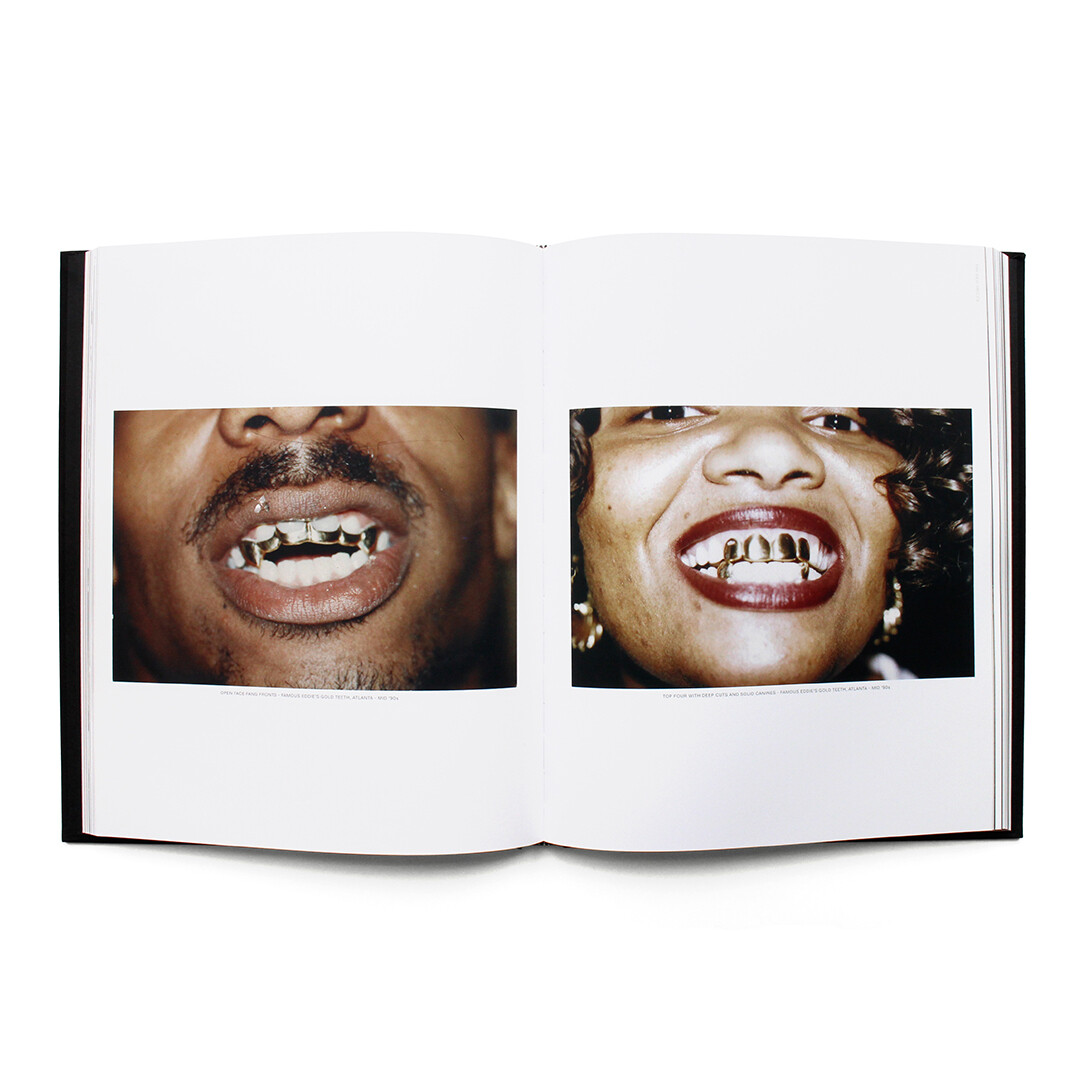 Mouth Full Of Golds