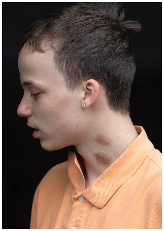 Winter Vandenbrink: Hickey