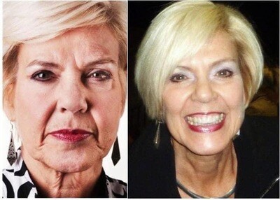 Aging