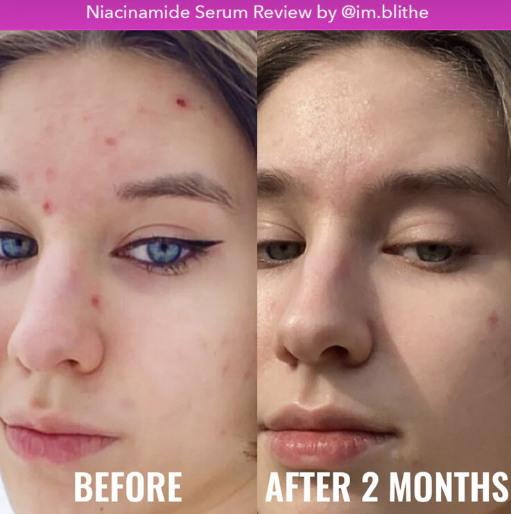 GOOD MOLECULES- Niacinamide Serum
