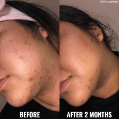 GOOD MOLECULES- Discoloration Correcting Serum