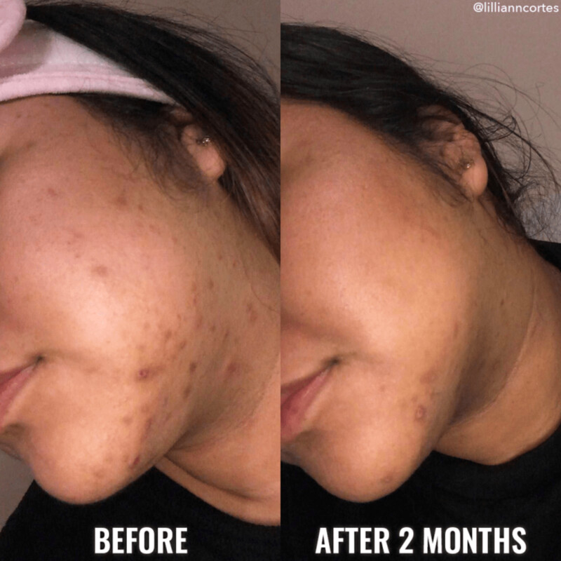 GOOD MOLECULES- Discoloration Correcting Serum