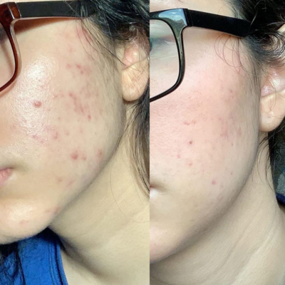 CERAVE- Resurfacing Retinol Serum Cerave