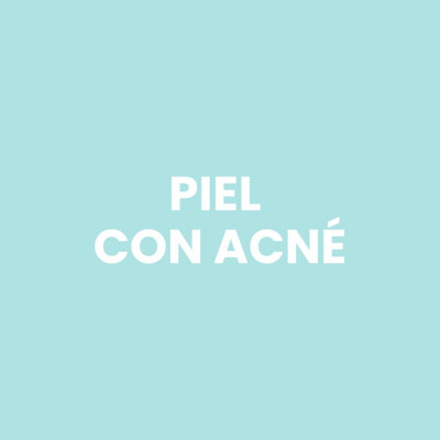 Piel con Acné