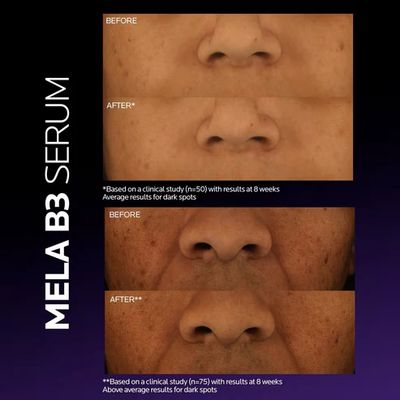 LA ROCHE POSAY- Mela B3